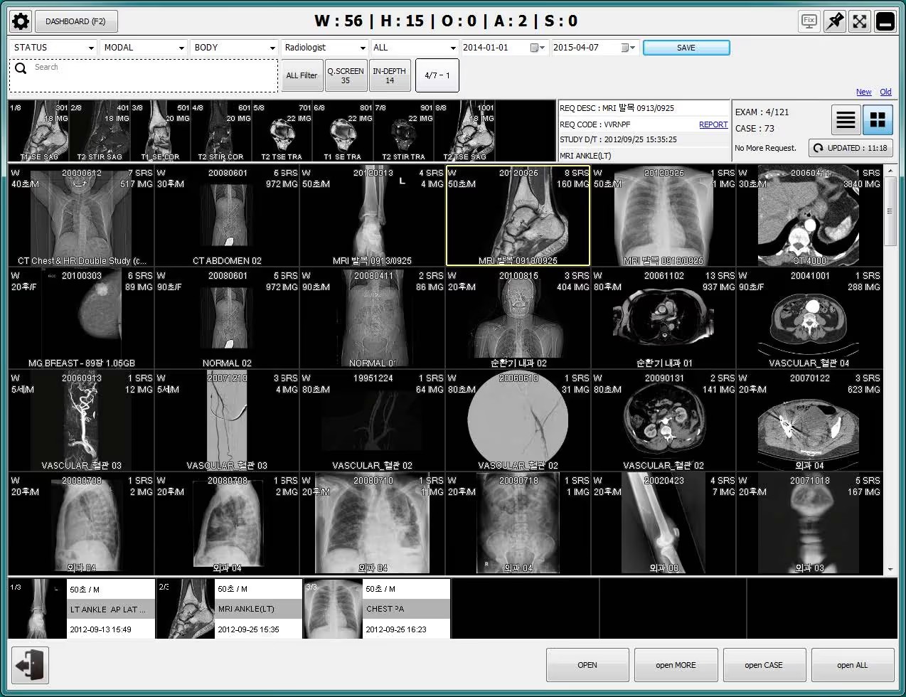 ZolView example 01